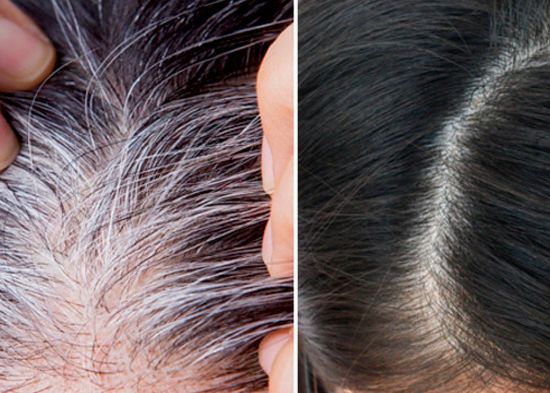 SHAMPOO CUBRE CANAS ➕ COLÁGENO Y EXFOLIANTE GRATIS