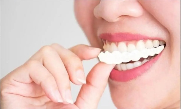 CARILLAS DENTALES SNAP ON SMILE PAGA 1 LLEVA 2
